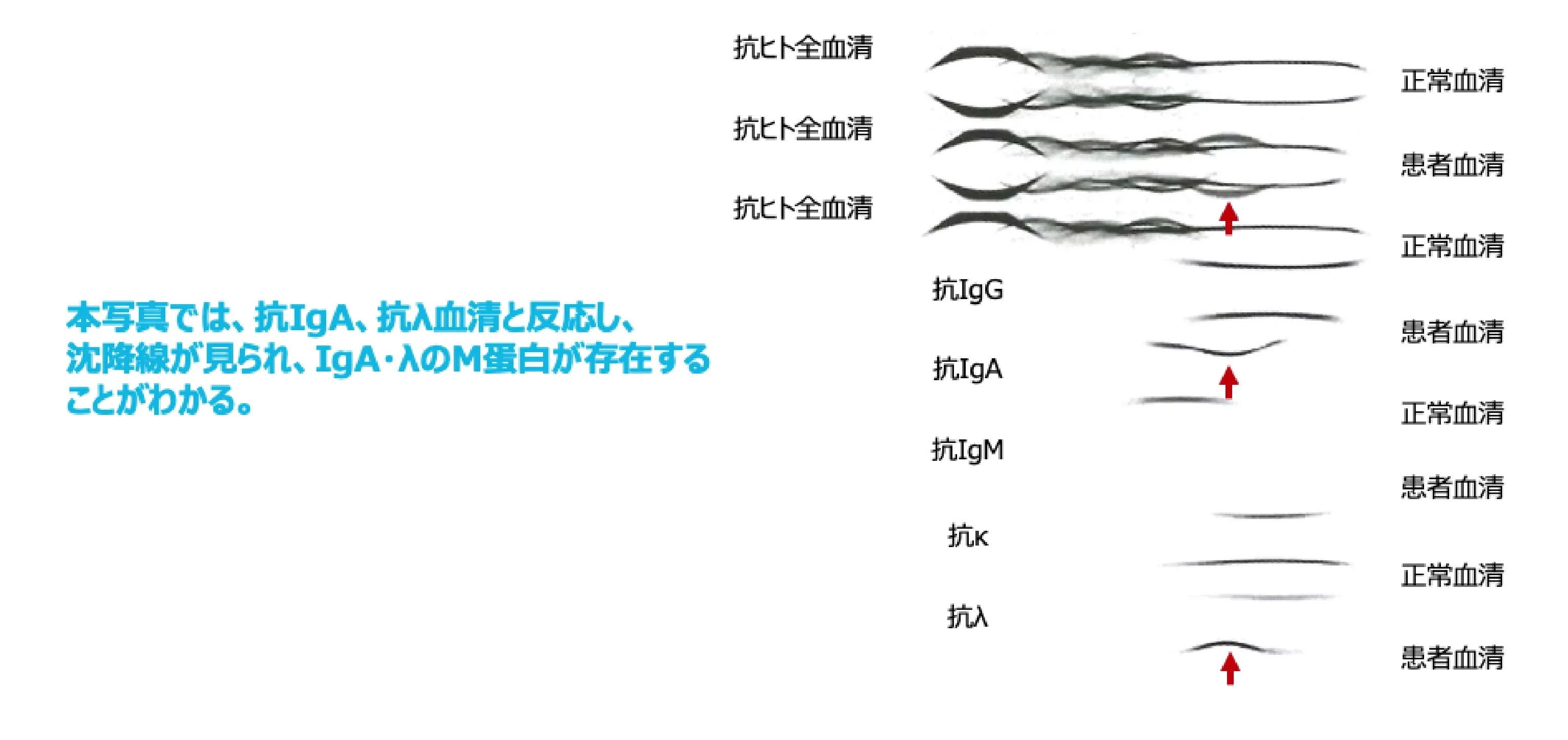 免疫電気泳動法1)