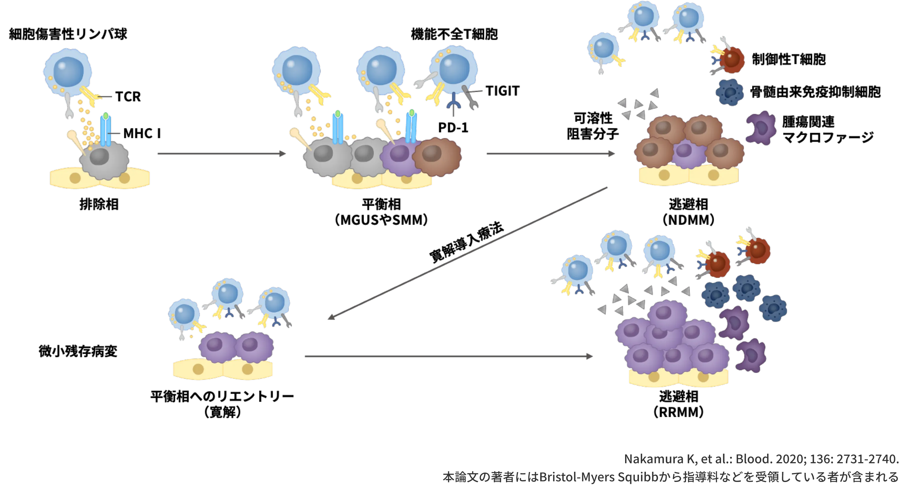 MMの進展や病勢進行における腫瘍免疫微小環境（TiME）の重要性が示されている